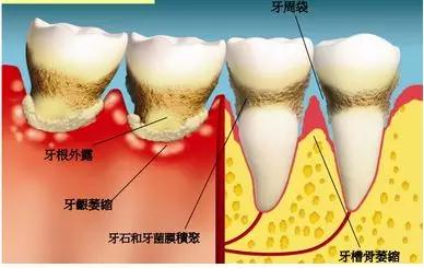 尊龙凯时阳光口腔超多全科诊疗福利